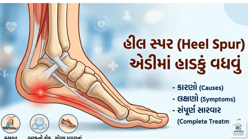 હીલ સ્પર (Heel Spur - એડીમાં હાડકું વધવું) ની સારવાર