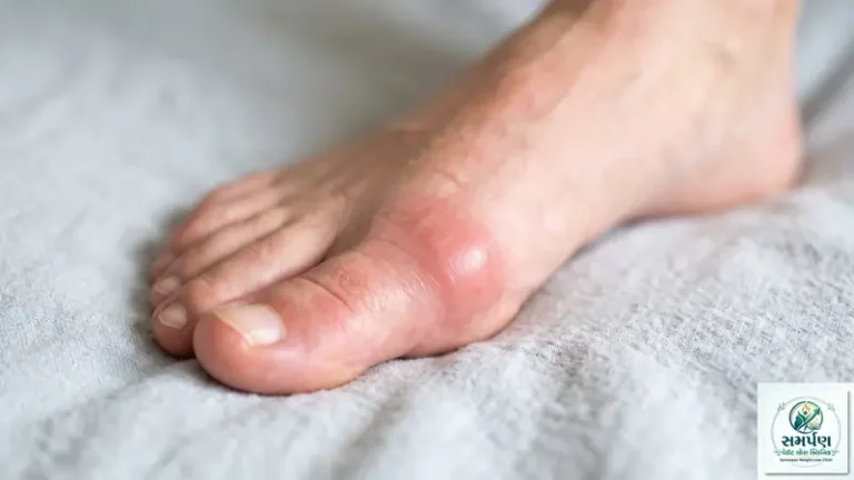 પગના અંગૂઠાનો દુખાવો અને સોજો (Gout / Bunion): કારણો અને ઉપાયો.
