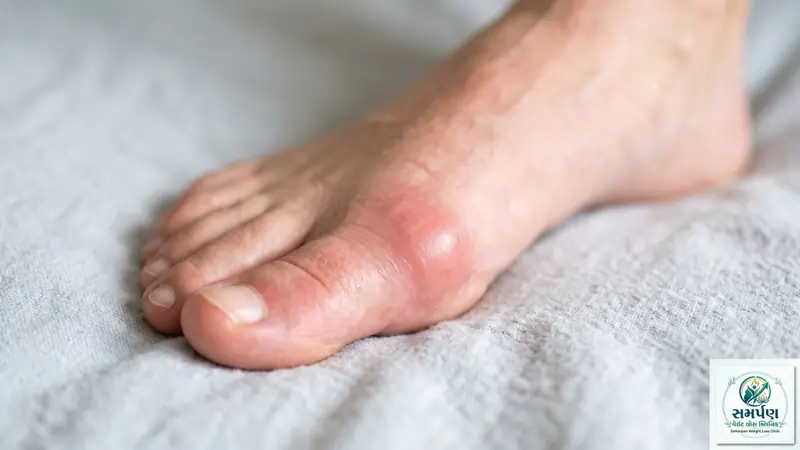 પગના અંગૂઠાનો દુખાવો અને સોજો (Gout / Bunion): કારણો અને ઉપાયો.