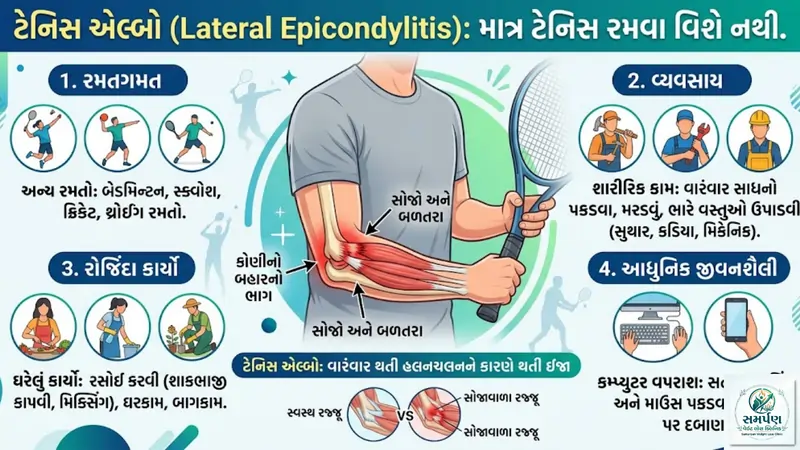 . ટેનિસ એલ્બો (Tennis Elbow) નું કારણ માત્ર ટેનિસ રમવું નથી: સાચું કારણ જાણો.